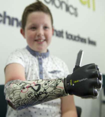 Youngest Person To Be Fitted With A Bionic Hand Kiwi Kids News